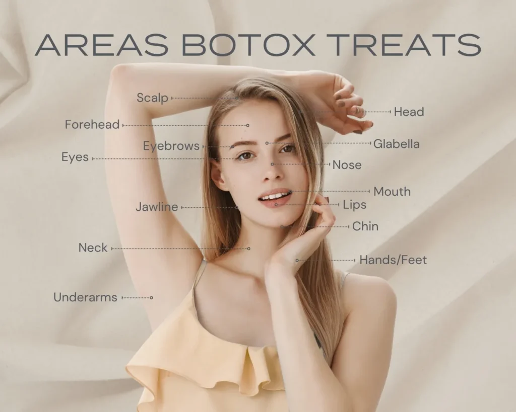 Areas Botox Treats